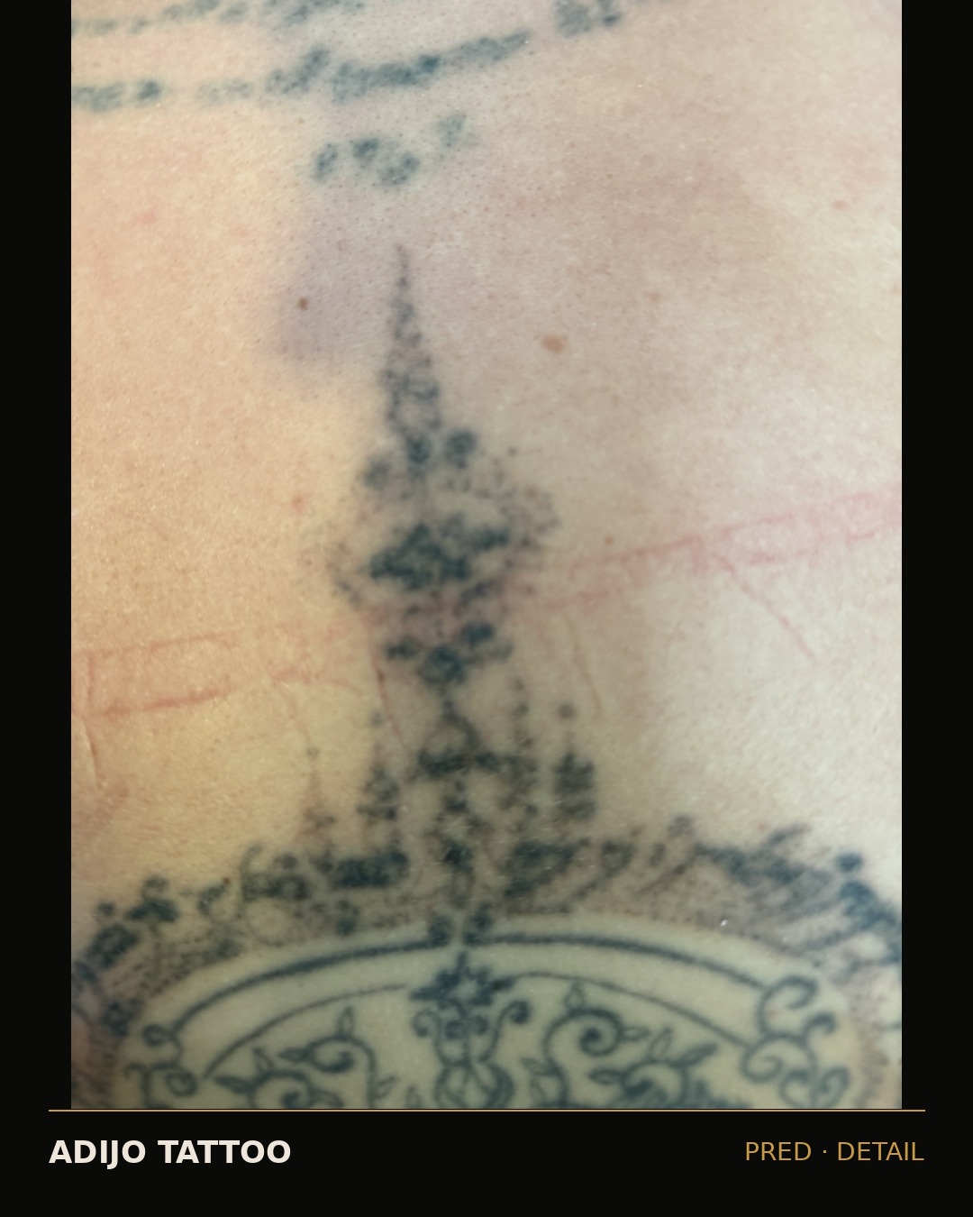 Odstranjevanje tetovaž – Adijo Tattoo 10 večji črni ornament pred odstranjevanjem tatuja