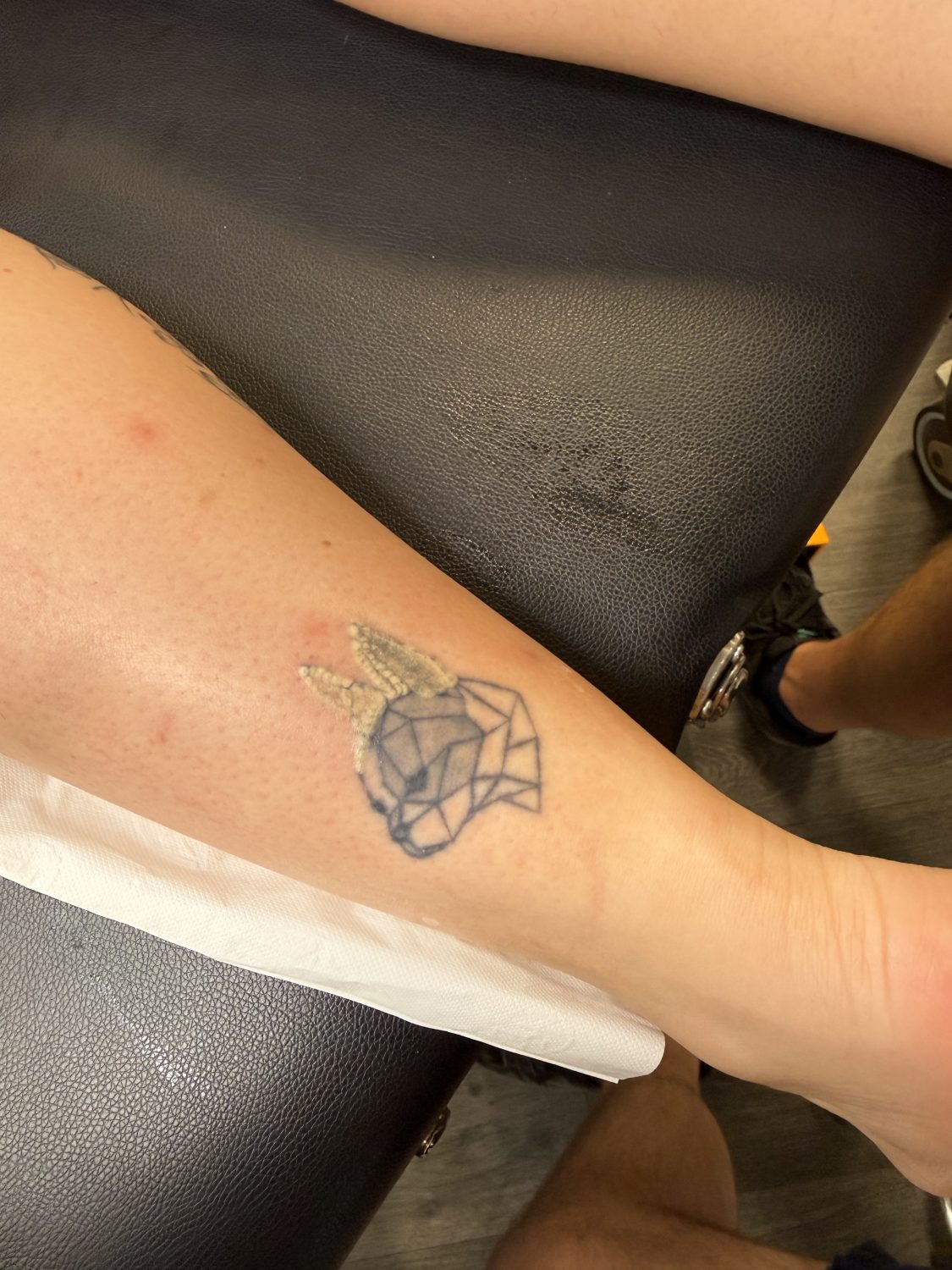 Odstranjevanje tetovaž – Adijo Tattoo 4 odstranjevanje tetovaž pred tretmajem Maribor